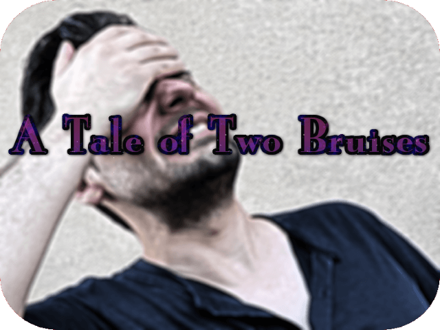 A Tale of Two Bruises